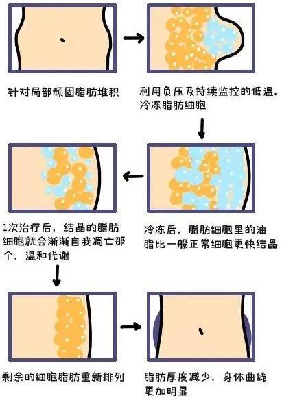 武漢藝星整形醫院:6月22-28日酷塑減脂專場,讓你輕輕松松的減肥!