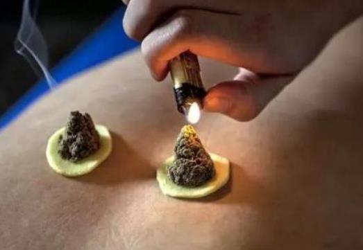 艾灸減肥效果好嗎?艾灸減肥是什么原理?