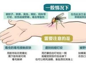 被毒蚊子咬了怎么辦？蚊子咬了怎么消腫止癢