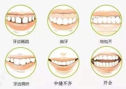 貴陽牙齒矯正哪家好,牙齒稀疏可以做矯正嗎?