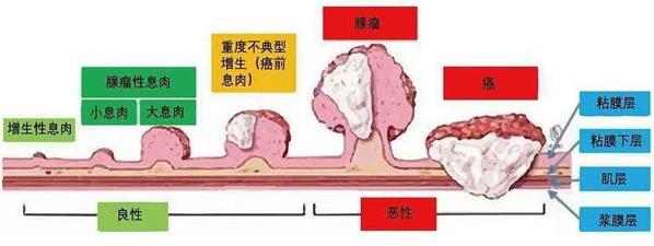 武漢漢西博仕肛腸醫院好不好 定期做肛腸檢查 可有效排查腸癌風險