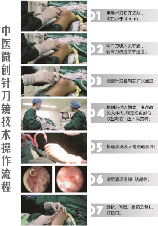 濟南中醫風濕病醫院中醫微創針刀鏡技術在痛風性關節炎中臨床應用