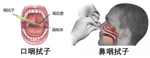核酸檢測結果陰性正常還是陽性是正常的?陽性為感染新型冠狀病毒