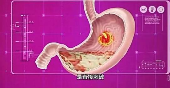 胃病都是“作出來”的!這7大傷胃壞習慣,你還在做嗎?