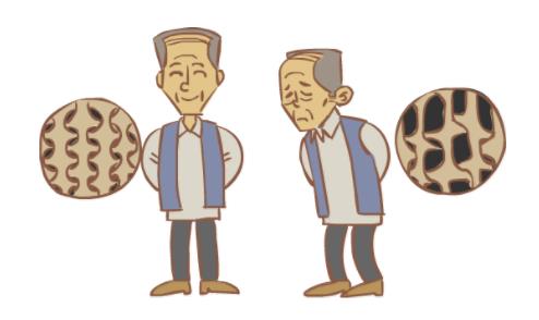 骨質疏松的癥狀有哪些,骨質疏松怎么辦?如何預防骨質疏松