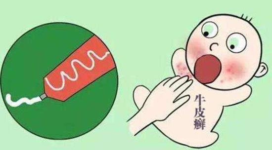 患了牛皮癬怎么護(hù)理?牛皮癬有哪些生理類型?