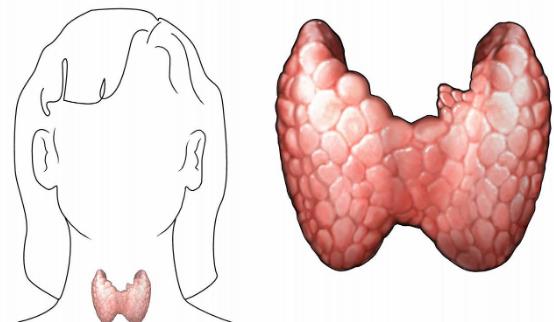 甲狀腺結節是什么?患甲狀腺結節有哪些癥狀?