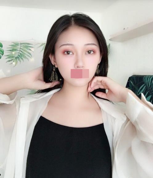 寧波玲瓏整形醫院解讀:除了忌口,做隆鼻也沒有我想的那么麻煩!