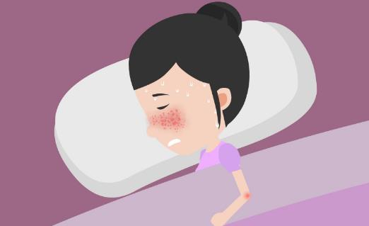 紅斑狼瘡的表現癥狀有哪些?患了紅斑狼瘡的注意事項?