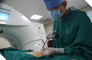 鄭州腫瘤醫院認準廣州復大腫瘤醫院:微創療法治腎癌多年未曾復發
