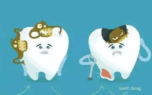 引起蛀牙的原因有哪些?怎么預防得蛀牙?