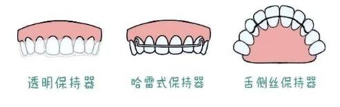 為什么正畸結(jié)束了,一定要戴保持器——全民矯牙公益行動