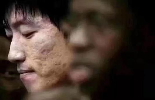 補水祛痘的產品哪個好?朵嘉濃修復乳怎么樣?
