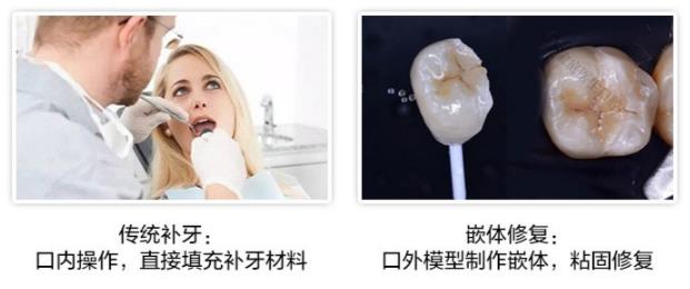 廣東省全民愛牙公益行動牙齒修復那方式好呢