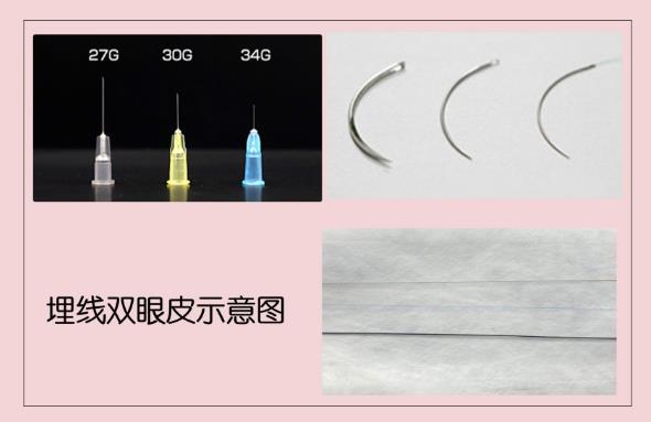 圣心醫療美容雙眼皮術:疫情期間,人人都是“眼”技派