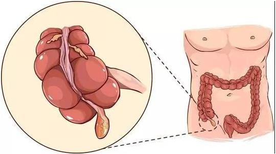 53歲阿姨查出甲狀腺癌,成都民生耳鼻喉為她成功實施手術