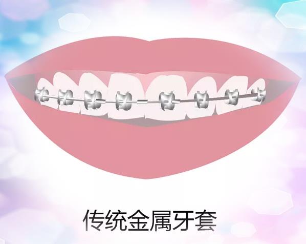 昆明德韓口腔牙齒矯正怎樣,專業值得信賴鑄造健康