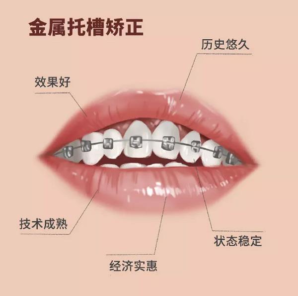 昆明成年人牙齒不齊怎么矯正?德韓口腔為您講解