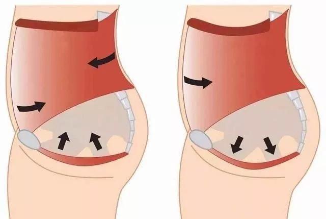 西安東大肛腸醫院:怎樣將痔瘡拒之門外,這些知識必看!