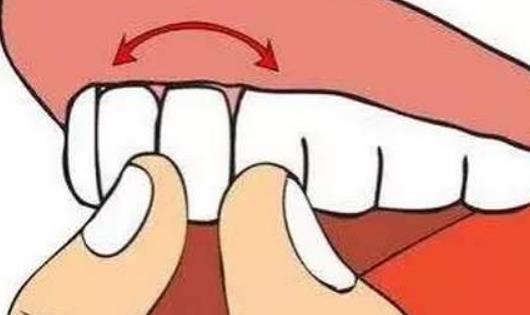牙齒松動的原因有哪些?吃什么可以固牙?