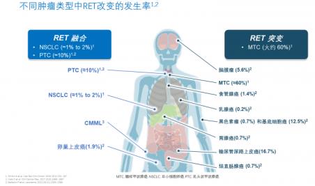 兩個月咳出腫瘤組織,高響應率非小細胞肺癌靶向藥將改變患者命運