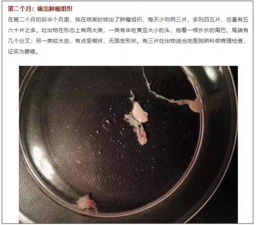 兩個月咳出腫瘤組織,高響應率非小細胞肺癌靶向藥將改變患者命運
