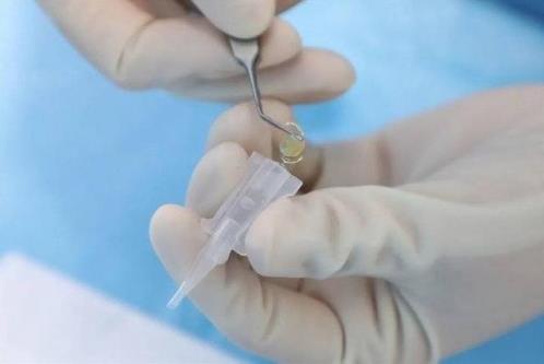 白內障、老花眼怎么治療?愛爾康自然視覺三焦晶體為你一次解決問題