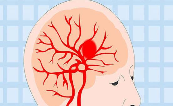 腦膜炎會引起白血病嗎?什么是病毒性腦膜炎?
