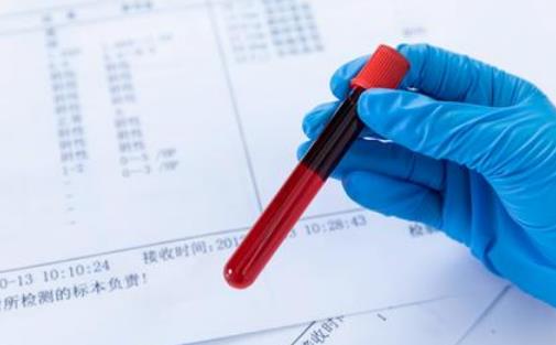 肝硬化性腎損害有哪些分類?肝硬化性腎損害做哪些檢查?