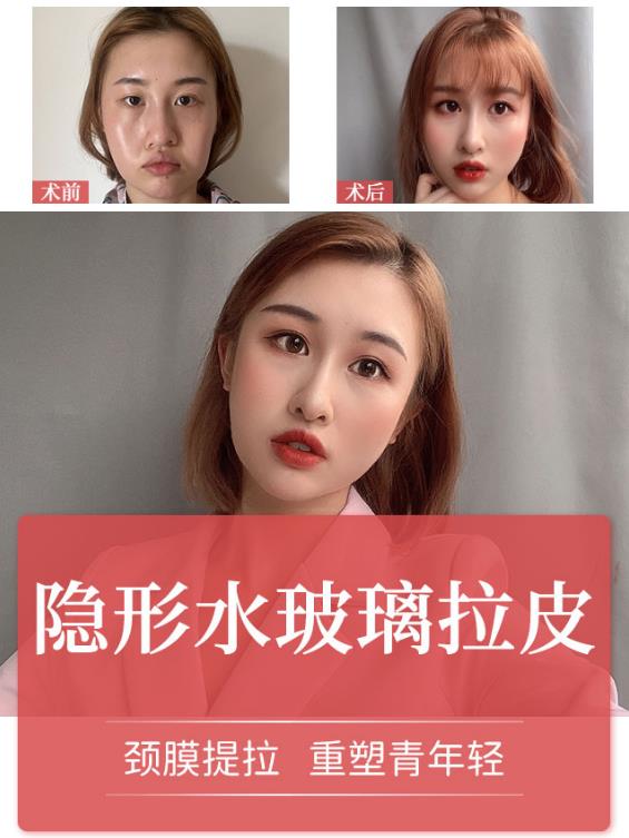 常州曙光整形醫(yī)院李智明主任好嗎 非手術(shù)治療,實現(xiàn)面部年輕化
