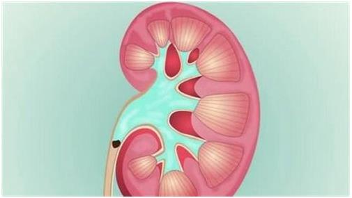云南結石病醫院腎結石患者:腎結石癥狀腰疼就像一把刀子來回絞動