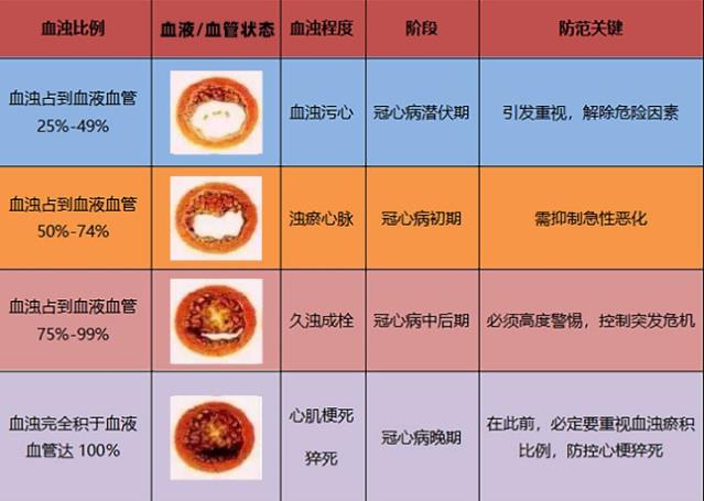 別把腰粗不當回事,有血濁助推,冠心病風險越大!