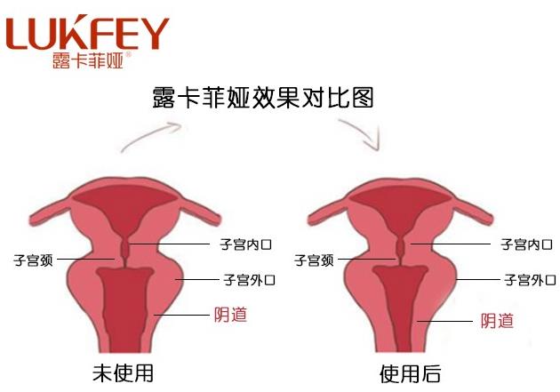露卡菲婭藥店有賣嗎?露卡菲婭官方購(gòu)買(mǎi)途徑!