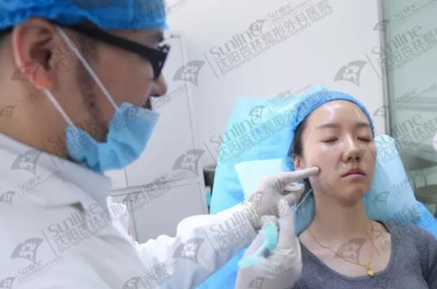 沈陽玻尿酸案例,有它才是女神的標配,重回十八歲!