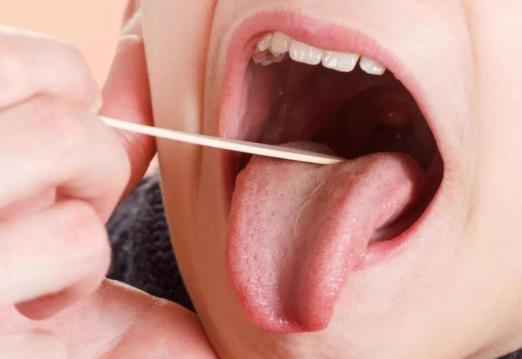 舌苔又白又厚是咋回事?舌苔厚白濕氣重怎么辦?