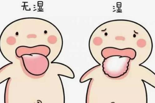 腸胃不好舌苔會是什么顏色?濕氣重的人舌苔會有什么表現?