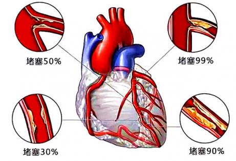 著名心腦血管專家邵陽博士坐診南京太乙堂