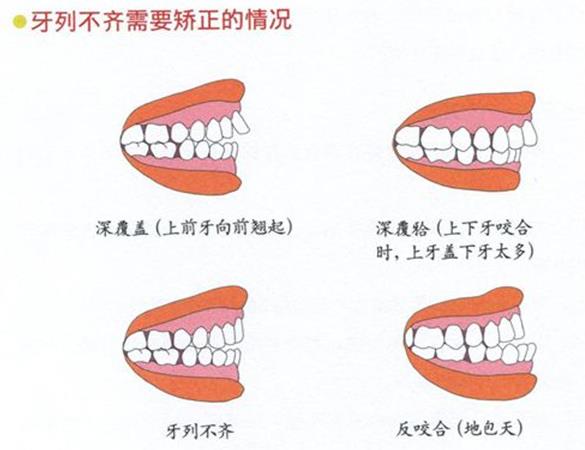 長沙德韓口腔牙齒矯正費用貴不貴?