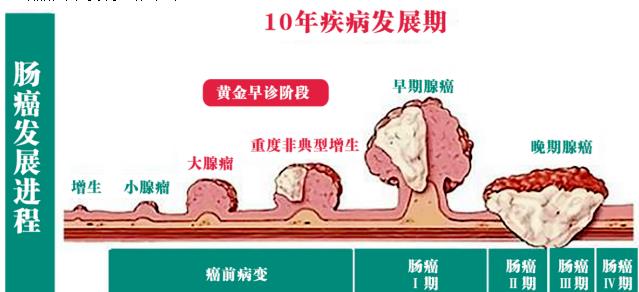 西安東大肛腸醫院:惋惜,那些被腸癌奪走的生命
