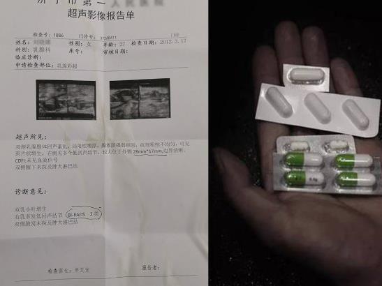 福乳堂金賢中醫好不好 乳腺增生怎么治好?