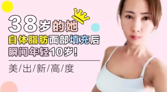 面部填充案例,沈陽(yáng)自體脂肪填充案例