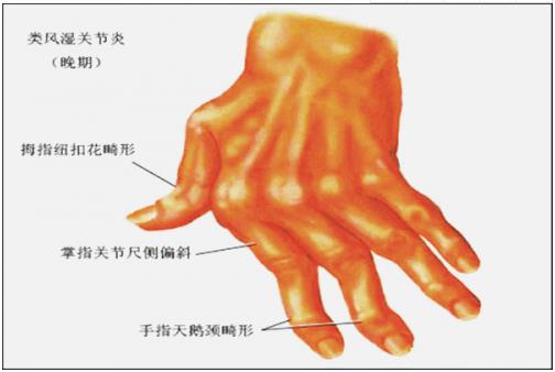 武漢國(guó)粹中醫(yī)館“三絕”名醫(yī)孔政