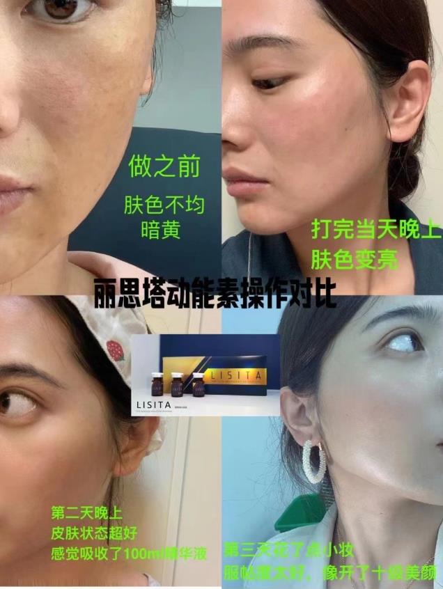 麗絲塔小金盒高級(jí)抗衰水光動(dòng)能素