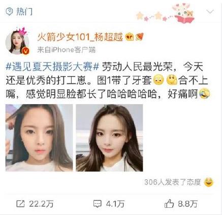 牙不齊顏值受影響?青島優諾·博士牙齒美學矯正