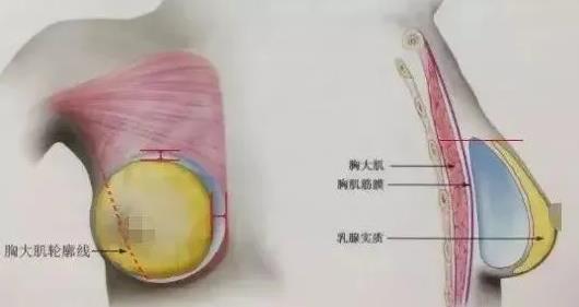 【濟南整形醫(yī)院排名】如何保證隆胸術(shù)后的手感呢?