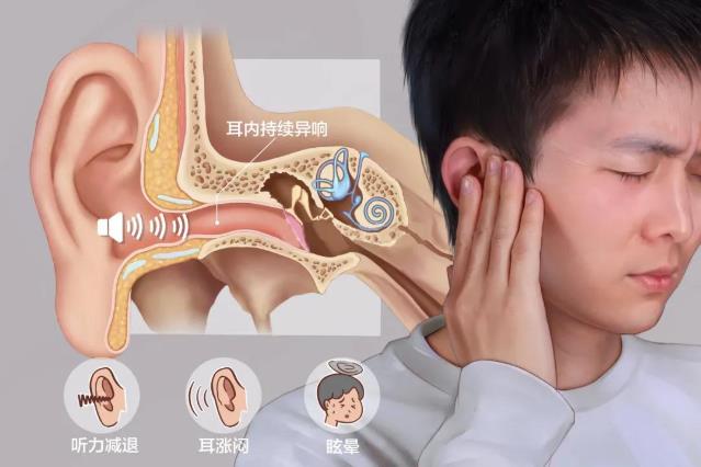 耳道瘙癢難忍又嗡嗡作響怎么辦?保定民眾耳鼻喉醫院怎么樣?