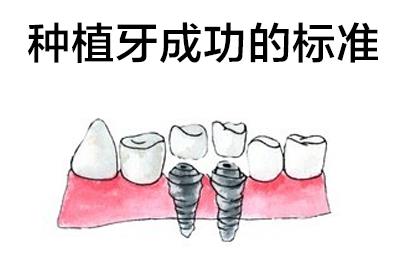 天津全口種植牙疼嗎貼吧_標準種植_選中諾口腔