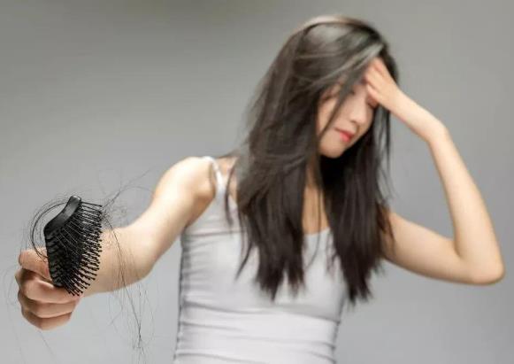 女生脫發吃什么?如何預防脫發