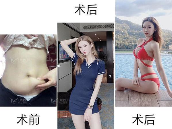 廣東韓妃整形醫院楊德發主任技術如何 定制你的天然美