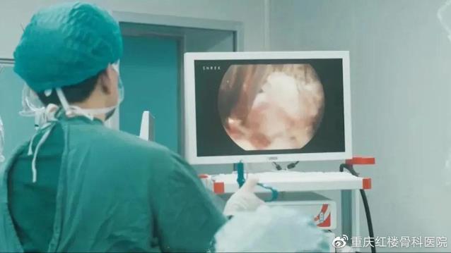 重慶知名的骨科醫院?重慶紅樓醫院微創術為腰椎滑脫患者消除病痛!